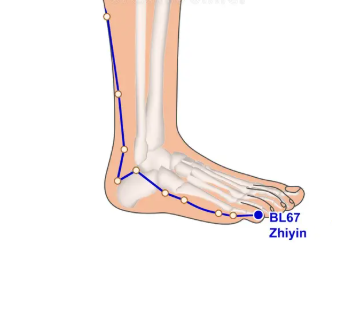 Técnica de moxibustión para presentación podálica o de nalgas en Vigo. Consulta matrona Cristina Valiñas